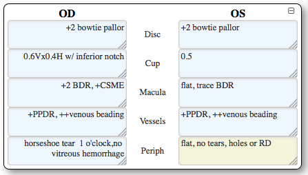 Sh retina EMR.png