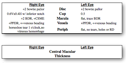 Sh retina report.png