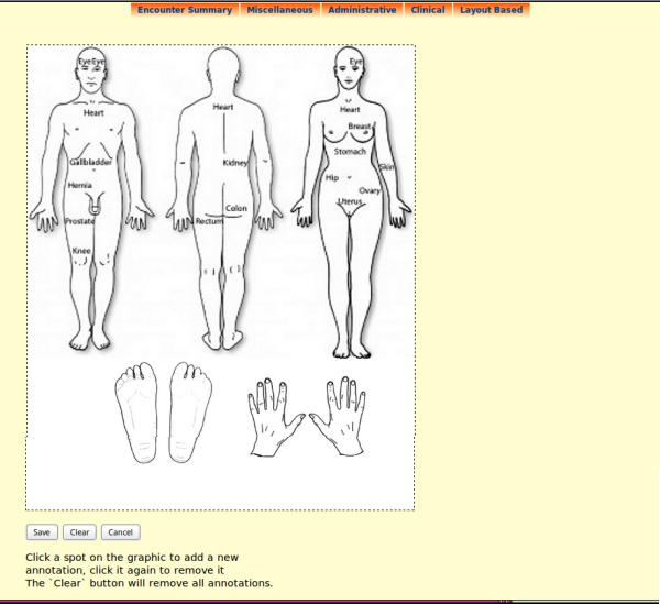 Graphic Pain Map