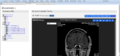 DICOM Document viewer 2 1035x486.png