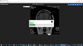 DICOM viewer0.25.jpeg