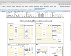 Amsler Grid Give-Away Sheets, 250/package